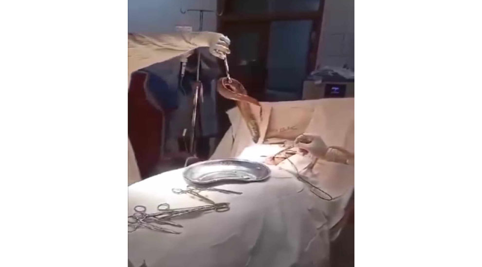 জেলের পেট থেকে 'জ্যান্ত কুঁচিয়া' উদ্ধার করলেন ডাক্তাররা