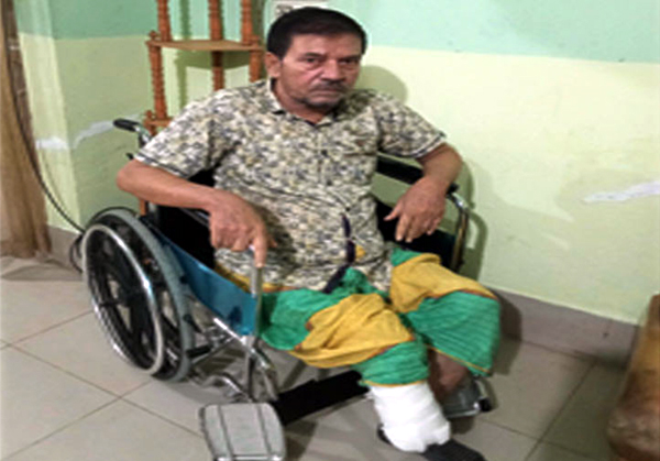 চিকিৎসার অর্থ পাচ্ছেন না পা হারানো সাংবাদিক