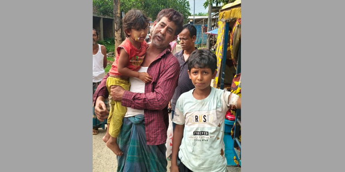 দোয়ারাবাজারে ভারতীয় বন্য শুকুরের হামলায় দুই শিশু আহত