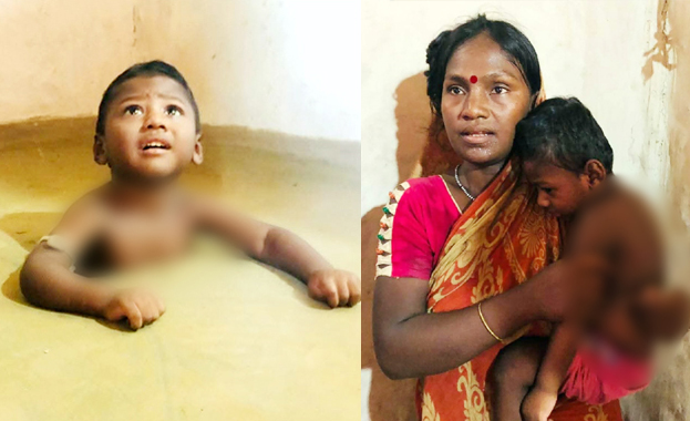 সুস্থতার আশায় প্রতিবন্ধী ছেলেকে বুকসমান গর্তে ঢুকিয়ে রাখেন মা