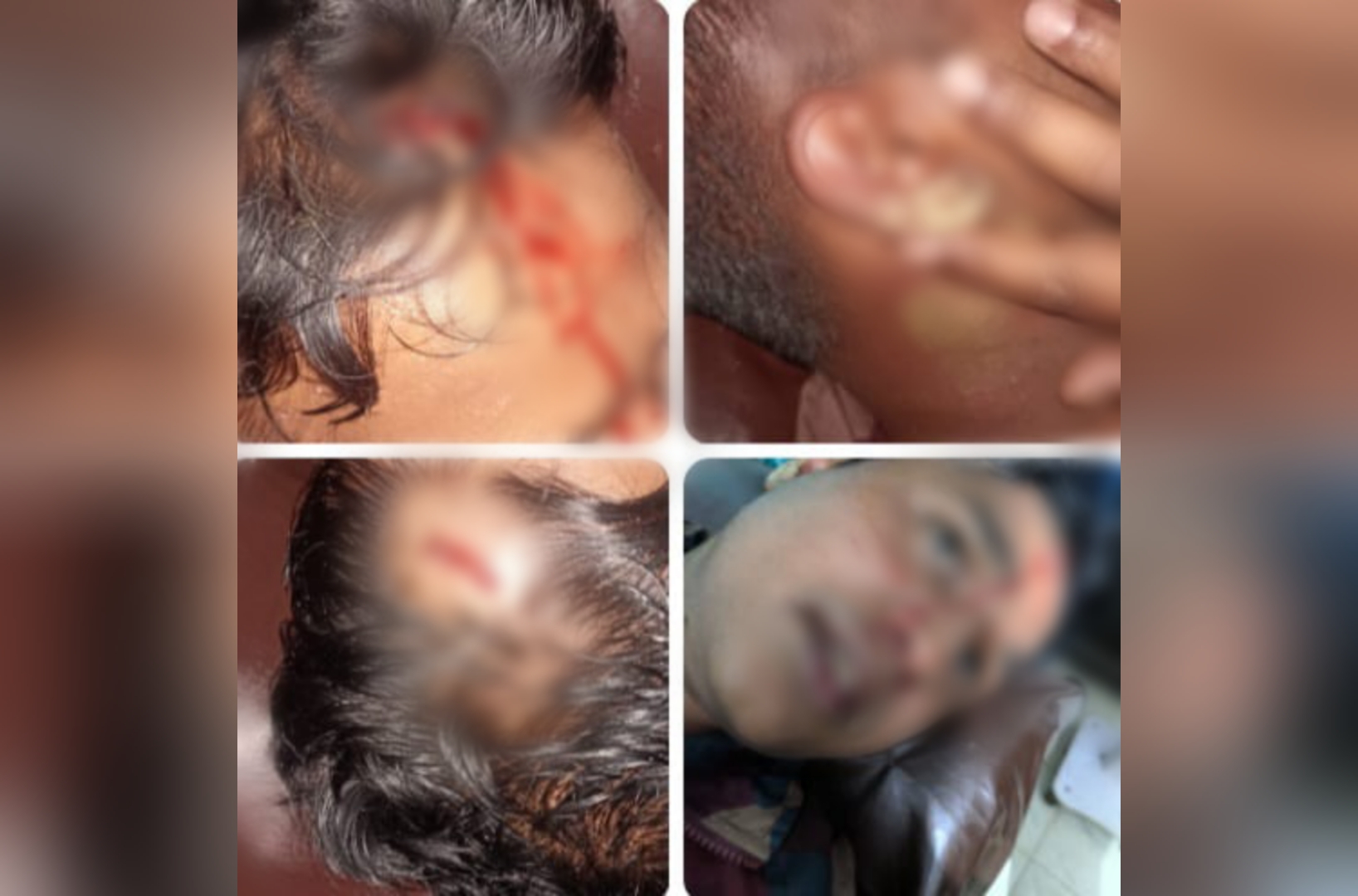 জৈন্তাপুরে চোরাকারবারিদের হামলায় ২ বিজিবি সদস্য আহত