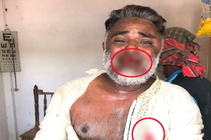 জুড়ীতে স্বতন্ত্র চেয়ারম্যান প্রার্থীর উপর হামলা : আটক ১