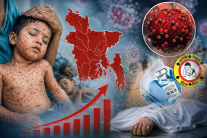 সিলেটে হামের উপসর্গে আরও এক শিশুর মৃত্যু সিলেটে হামের উপসর্গে আরও এক শিশুর মৃত্যু