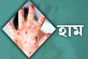 সিলেট হামে আরও এক শিশুর মৃত্যু সিলেট হামে আরও এক শিশুর মৃত্যু