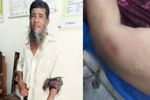 দুই ঘণ্টায় এক কুকুরের কামড়ে আহত ২৬
