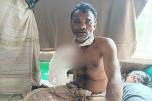 জৈন্তাপুর প্রতিবেশীদের হামলায় সুরুজ আলী'র ৩ আঙুল বিচ্ছিন্ন
